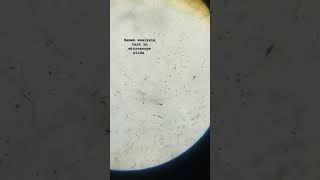 viralvideo semen analysis test in microscope slide viralreels viralshorts viralreels viralsong [upl. by Cocks]