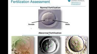 Embryo Selection and Transfer  Mass General Fertility Focus Webinar [upl. by Eitsim]