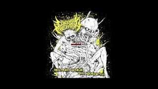 Congenital MalformationDeformed Siamese Twin AbominationFull Album 2013 [upl. by Lobiv]