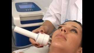 TriPollar face treatment with medium applicator [upl. by Hollington581]