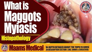 What is Maggots Myiasis Histopathology  Causes Symptoms and Treatment [upl. by Namhar785]