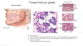 Pathology Made EasySystemic Pathology 15Head amp Neck Diseases2Oral cavity2Salivary Gland [upl. by Delwyn]