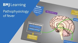 Pathophysiology of fever explained [upl. by Eleirbag591]