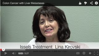 Colon Cancer with Liver Metastases [upl. by Kellene]