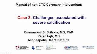 Case 3 PCI Manual  Challenges associated with severe calcification [upl. by Ripleigh66]