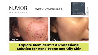 blemiderm® free the skin from blemishes [upl. by Hasheem867]