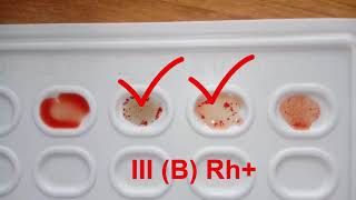 Работа 1 Определение группы крови резус фактора [upl. by Eanahc]