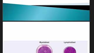 Acute lymphoblastic leukemia explained in urduhindi english [upl. by Faxen953]