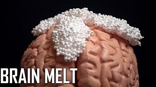 ASMR BRAIN MELT [upl. by Rogerson]