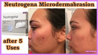 NEUTROGENA MICRODERMABRASION Review before amp after [upl. by Tav]