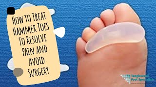 How to Treat Hammer Toes To Resolve Pain and Avoid Surgery [upl. by Eirok]