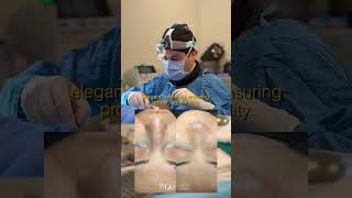 Behind the Scenes A Day in Rhinoplasty Surgery with Assoc Prof Dr Güncel Öztürk [upl. by Bromleigh]