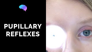 Pupillary Reflexes  OSCE Guide Clip  UKMLA  CPSA [upl. by Divad]