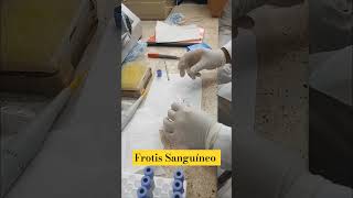 ¿Cómo hacer un frotis sanguíneo hematología labortorioclínico ciencia science quimicaentodo [upl. by Iverson843]