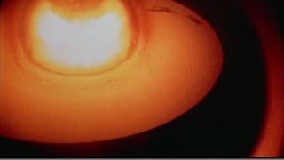 Castle Bravo  Huge thermonuclear explosion [upl. by Muriah]