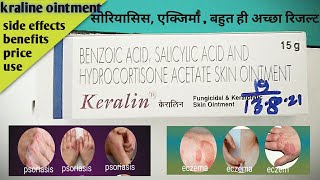 keraline ointment uses keraline ointment price keraline ointment benefits keraine in hindi [upl. by Airelav15]