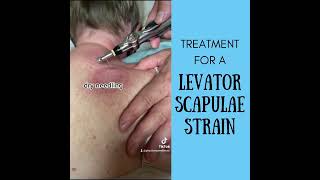 Treatment for Levator Scapulae Strain [upl. by Aya384]