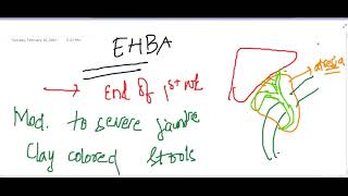 extrahepatic biliary atresia  Pediatrics [upl. by Blodgett857]