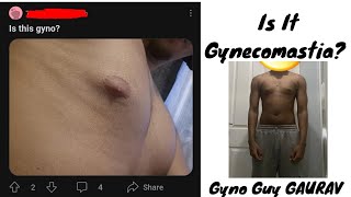 How to check Gynecomastia  Is it Gyno PART1 [upl. by Emmalynne]