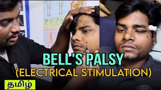 Electrical Stimulation for Bells Palsyதமிழ்Motor points for Bells Palsybellspalsy [upl. by Zwick]