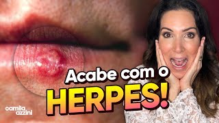 Herpes cuidados e suplementos [upl. by Azmuh]