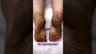 DIY Cracked Heels CreamGet Rid Of Cracked Heels Winter Special Cracked Feet Cream ytshortsviral [upl. by Hairem]