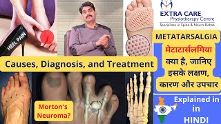 Metatarsalgia  Causes Diagnosis and Treatment  पंजों में दर्द  Mortons Neuroma  in HINDI [upl. by Popelka]