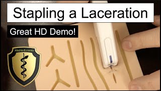 Closing a Laceration Using a Skin Stapler  Stepbystep instructions [upl. by Almena]