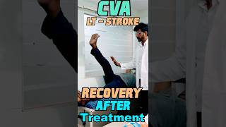 CVA LTSTROKE Recovery After Treatment motivation treatment trending yt ytshorts fyp ad [upl. by Aysan]