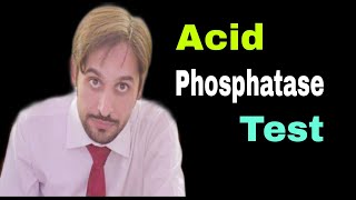 Acid phosphatase test ACP  Importance in Prostate Cancer [upl. by Vallo]