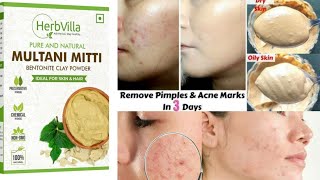 herbvilla multani mitti powder review multani mitti benefits anti acne face pack [upl. by Necaj]