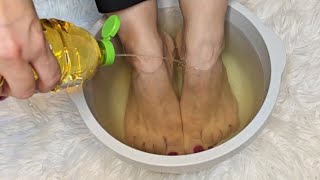 I soaked my feet in APPLE CIDER VINEGAR and 15 minutes later I was shocked at what happened [upl. by Suoirtemed]