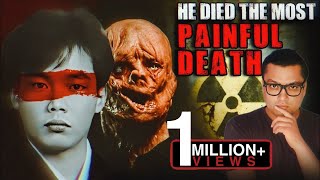 वो अपने मरे शरीर में 83 Days तक तड़पता रहा The Most Painful and Scary Story of Hisashi Ouchi [upl. by Dremann302]