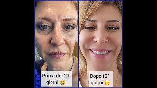 ORMONI IN FUGA Il primo Videocorso di Nutrizione antiaging con dieta di 3 settimane [upl. by Ykceb224]