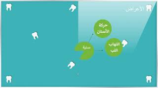 Temporomandibular Joint Disorder اضطربات المفصل الفكي الصدغي [upl. by Dalis]