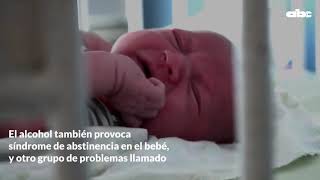 Síndrome de Abstinencia Neonatal [upl. by Aikemit]