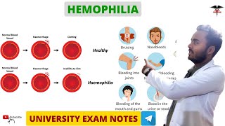 Hemophilia  Blood Clotting Disorder  Blood physiology [upl. by Alikee]