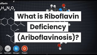 What is Riboflavin Deficiency Ariboflavinosis [upl. by Lanaj]