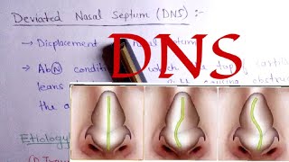 Nasal Septum deviation  DNS  Notes for NEET PG [upl. by Lombardo]