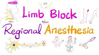 Limb Block  Peripheral Nerve Block  Regional anesthesia [upl. by Enneibaf]