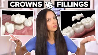 Dental Crowns Vs Dental Fillings Whats the Difference [upl. by Gudrin419]