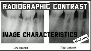 RADIOGRAPHIC CONTRAST II IMAGE CHARACTERISTICS II IDEAL RADIOGRAPH II ORAL RADIOLOGY [upl. by Lesiram446]