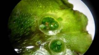 Liverwort Gemmae Cups [upl. by Aerdnas]