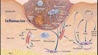 Inflamación Aguda  Fisiopatología [upl. by Nayk]