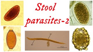 Stool parasitespart 2  Nematodes  Round worm  Pin worm  Hook worm  Whip worm  Thread worm [upl. by Yren250]