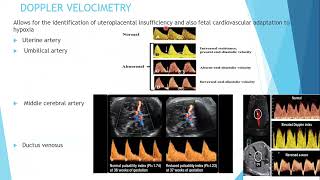 FGR Screening amp Management Protocol  Dr L Hlatywayo [upl. by Nilkcaj]