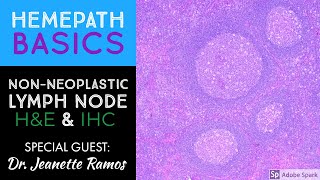 Hemepath Basics NonNeoplastic Lymph Node Histology amp Immunostains with Dr Jeanette Ramos [upl. by Virginia]