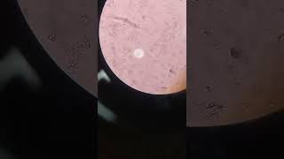 RBC  pus cell  amorphous urates  yeast cells  bacteria in urine R E viralvideo fypyoutube [upl. by Cinderella]