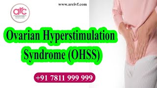 Ovarian Hyperstimulation Syndrome OHSS  ARC Kovai [upl. by Alleul393]