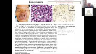 Klebsiella Enterobacter proteus and other enterobacteria [upl. by Nwahsel]